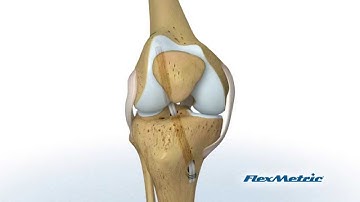 FlexMetric® ACL Reamer