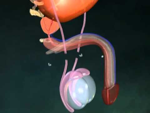 3D моделированние мужской стерилизации