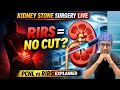 Kidney Stone Laser Surgery LIVE,RIRS बिना चीरे पथरी का इलाज Must Watch Before Operation