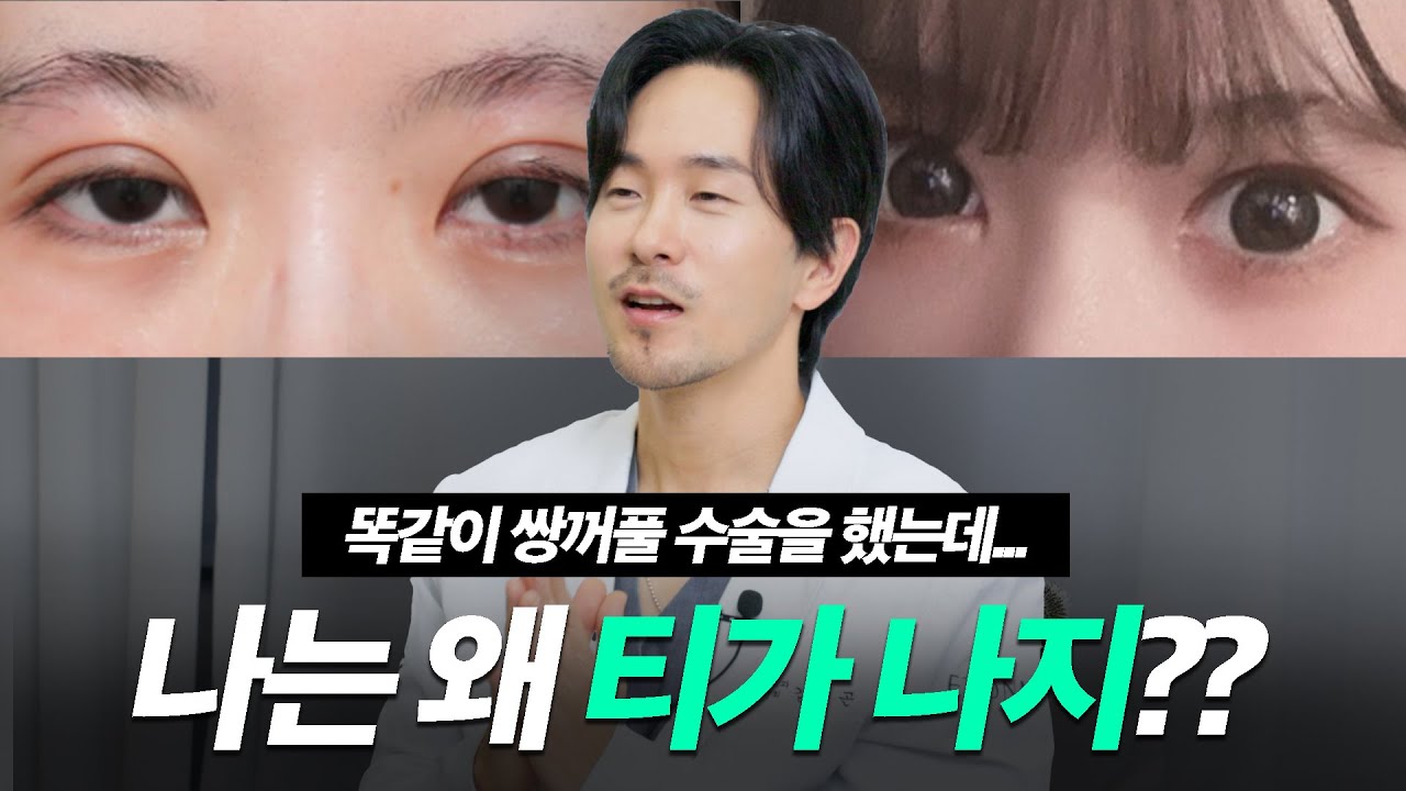 성형한 티가 안나면서 눈이 예뻐지는 방법