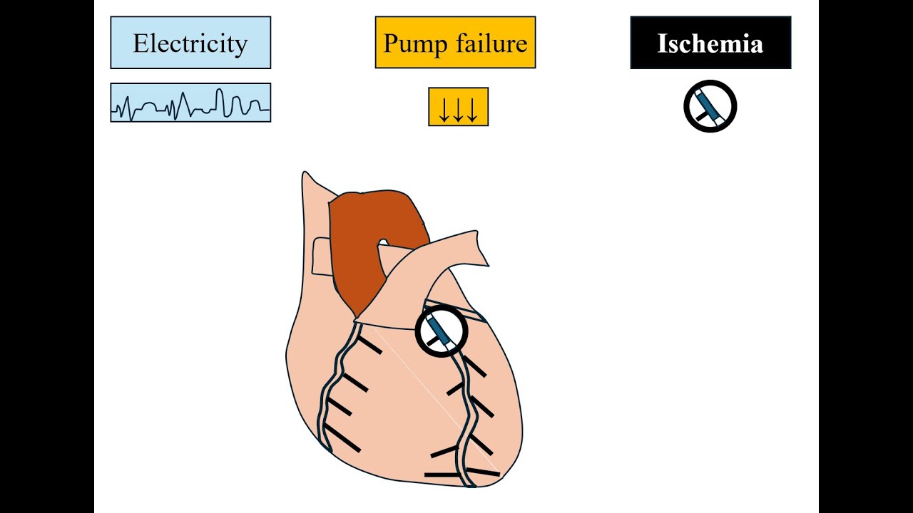 Cardiac check-up: The key to safe non cardiac surgery