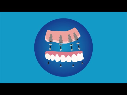 Βίντεο: Πώς να ονομάσετε μια οδοντιατρική κλινική