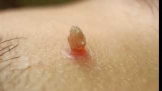 Venas piel y