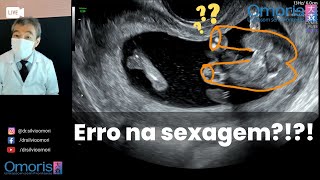 SEXING ERROR?!?! Pregnancy 15 weeks.