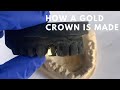 How A Gold Crown Is Made 