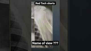 #radiologyshorts #radiology #radiographer #redtechshorts #education