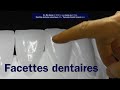 Facettes dentaires  - No #15+ (etapes) - Dr. Éric Hazan, Paris 16