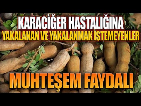 Karaciğer Hastalığına Yakalanan ve Yakalanmak İstemeyenler... Muhteşem Faydalı!