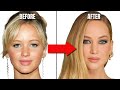 Jennifer Lawrence&#39;s Plastic Surgeries: The High Cost of Perfection