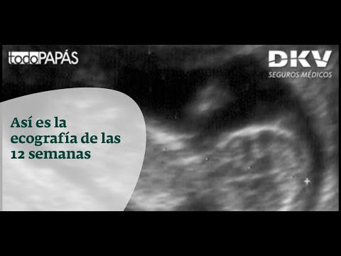 Video: 12 Semanas De Embarazo: Sensaciones, Desarrollo Fetal, Ecografía