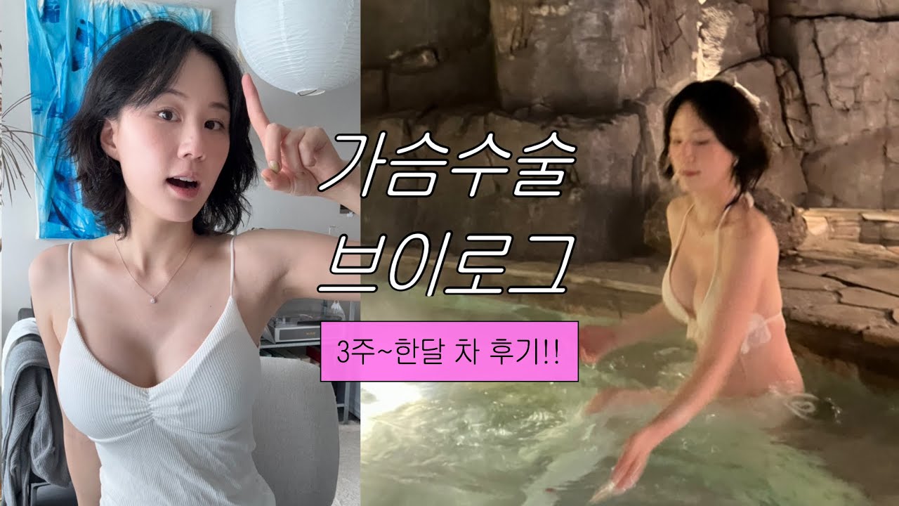 가슴수술 3주~한달 차 후기 | 가슴수술 브이로그 3편