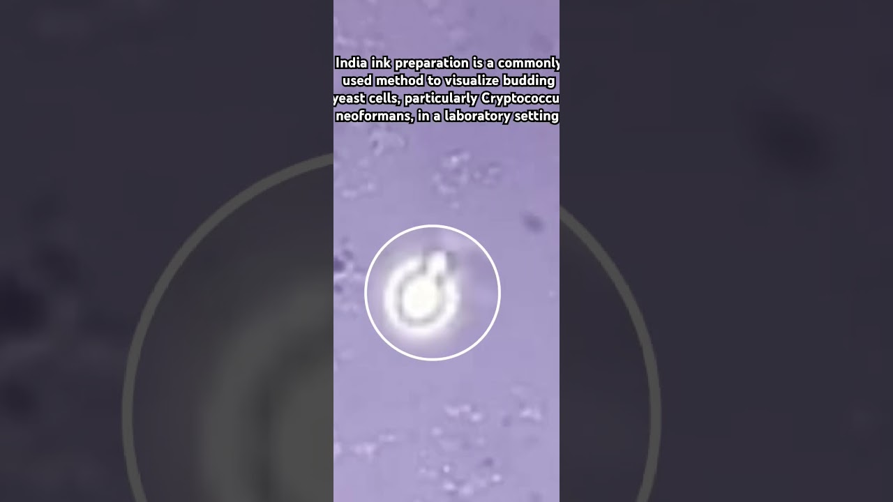 Budding yeast in csf india ink preparation 