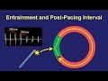 Entrainment mapping the postpacing interval