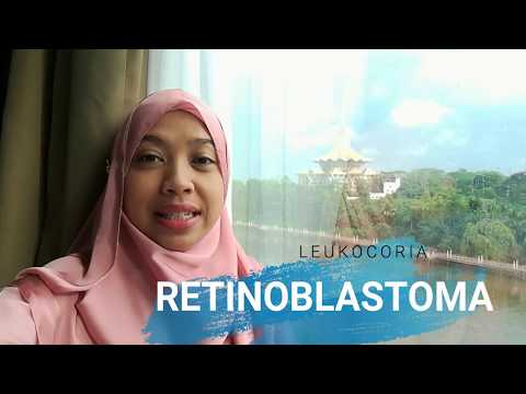 Video: Retinoblastoma Pada Kanak-kanak - Rawatan, Diagnosis, Sebab