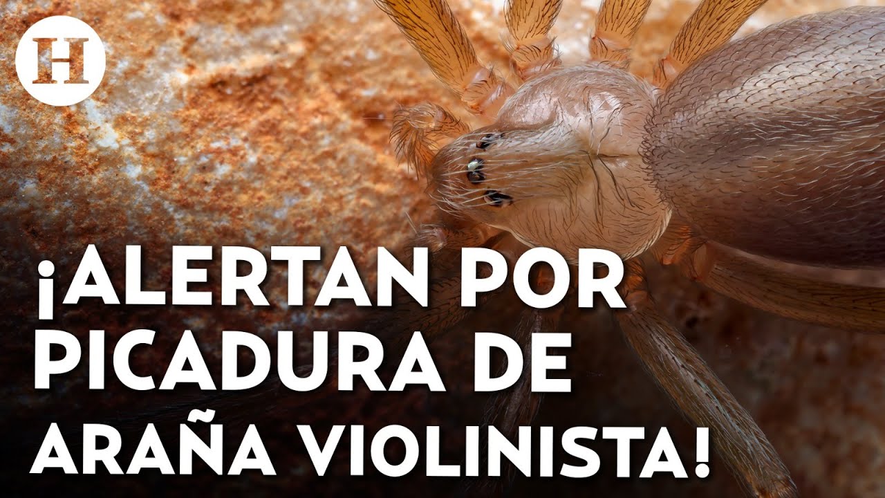 ¿Cuáles son los síntomas por picadura de araña violinista? Esto debes hacer si te encuentras con una