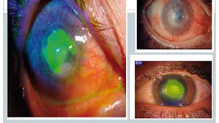 Urgencias Oftalmológicas