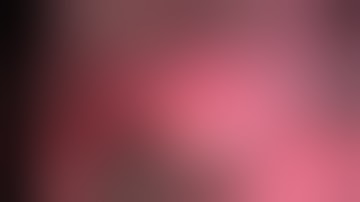 Asvide: Right lower lobe superior segmentectomy S6