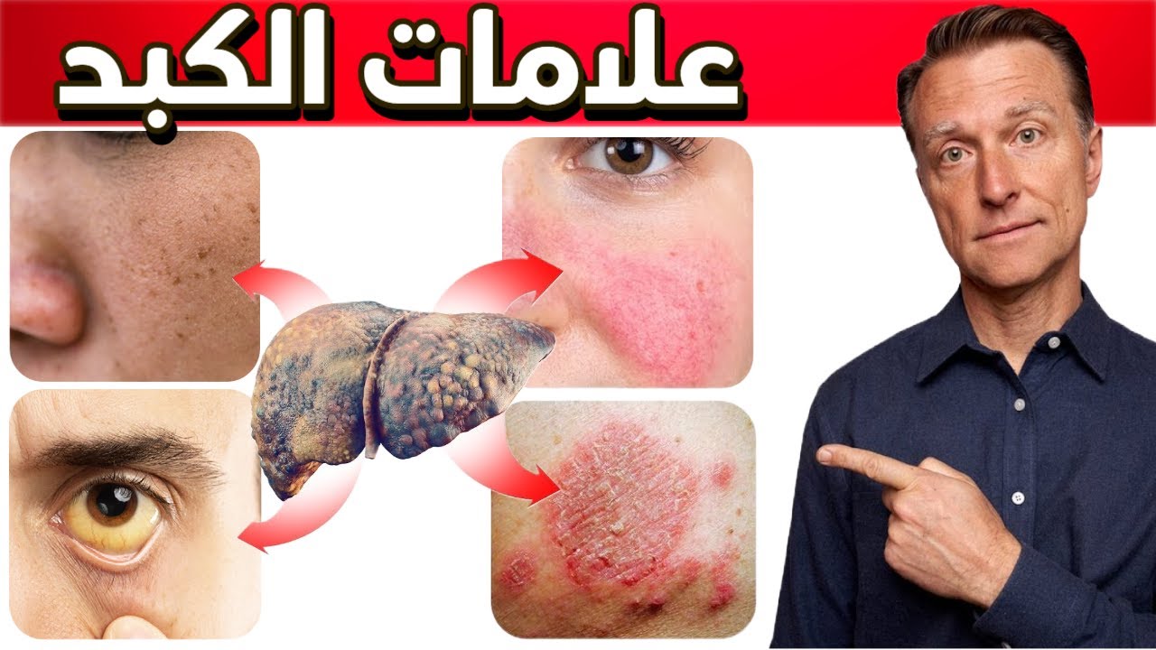 هذه العلامات تدل على مشكلة في الكبد لا تهملوها أبداً