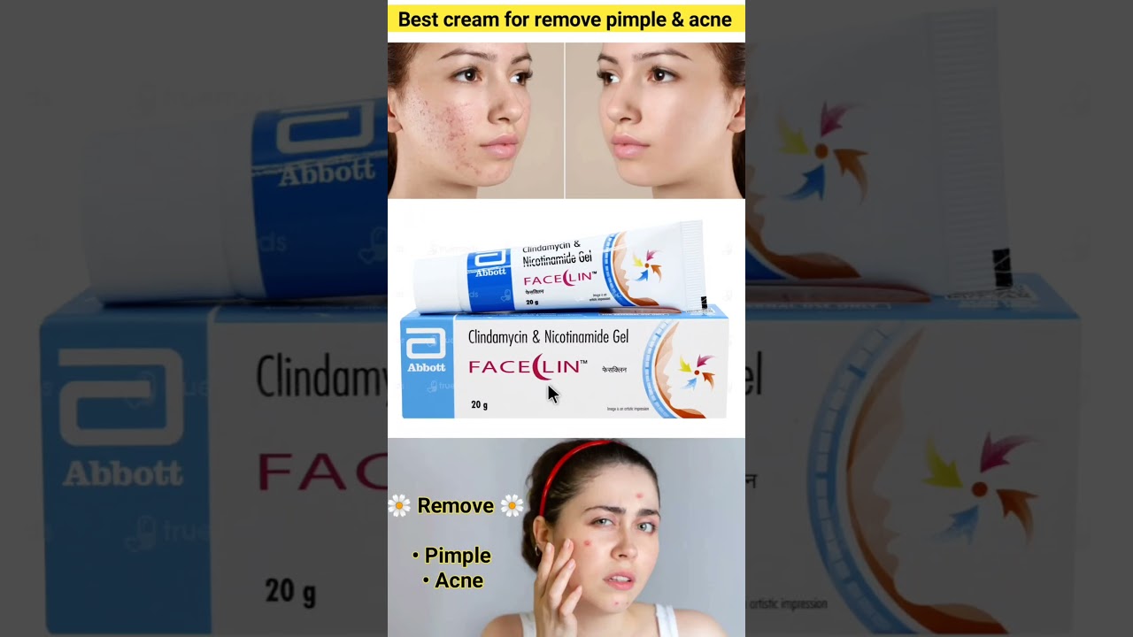 pimple aur acne ka ilaj | faceclin gel 