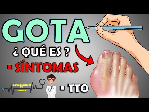 Video: 3 formas de reconocer los síntomas de la gota