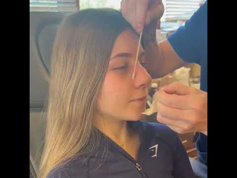 Video thumbnail: Rhinoplasty Cast Removal — Winslow Facial Plastic Surgery