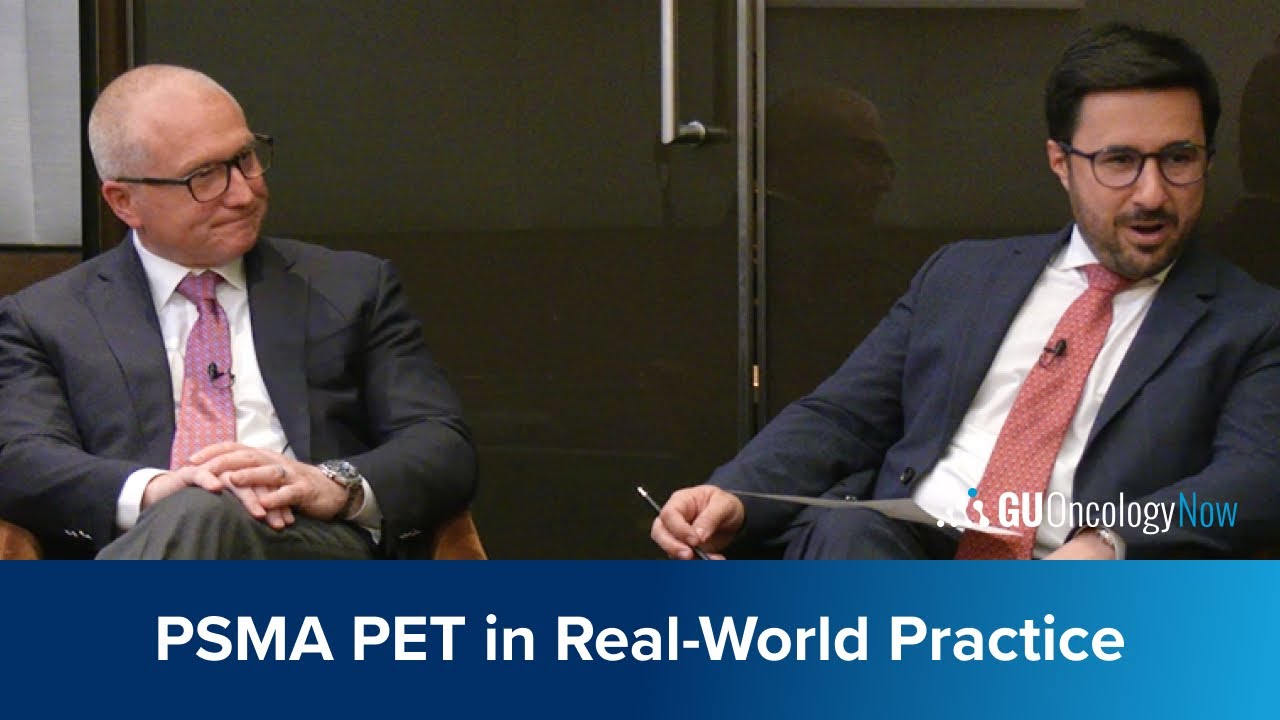 Redefining Prostate Cancer Staging: PSMA PET in Real-World Practice