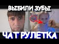 ВЫБИЛИ ЗУБЫ РЕАКЦИЯ ЛЮДЕЙ | ЧАТ РУЛЕТКА