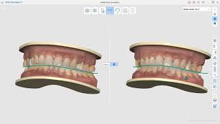 App Ortho Simulation en Medit Link