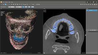 07 Multiple Teeth Segmentation
