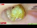 ASMR：こんなに詰まってるなんて、誰も想像できない…