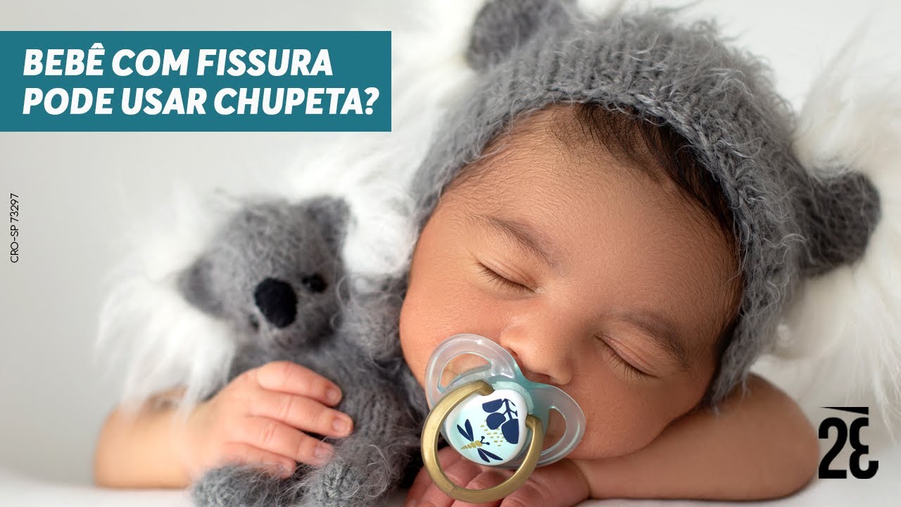 FISSURA LABIOPALATINA: BEBÊ COM FISSURA PODE USAR CHUPETA? | Dr. Zé ...