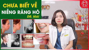 Giải đáp mọi thắc mắc về Niềng Răng Hô