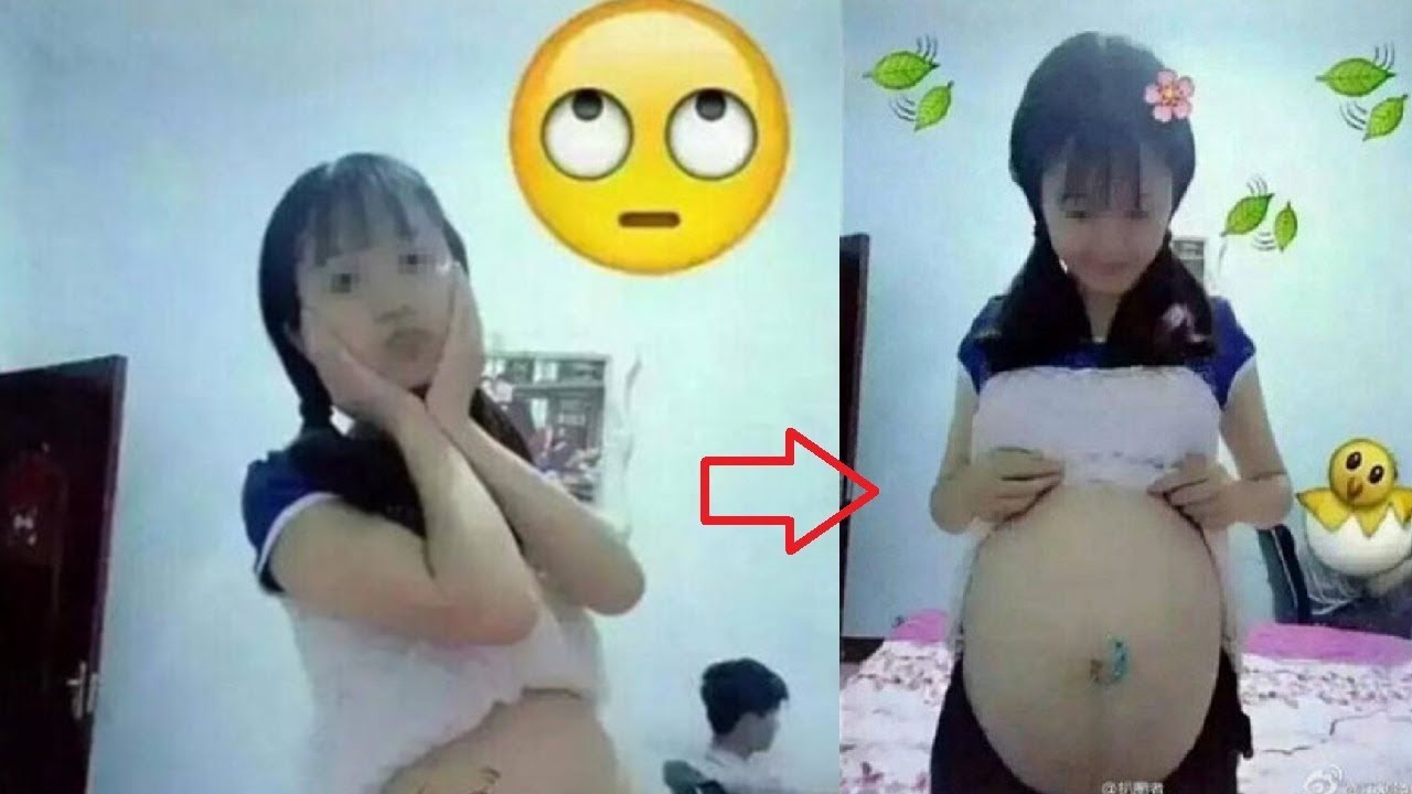 16 Year Old Chinese Girl Shares Photos Of Her Pregnant Stoma