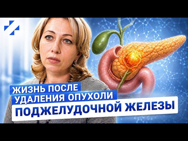 Рассказывает пациентка. Жизнь после панкреатодуоденальной резекции