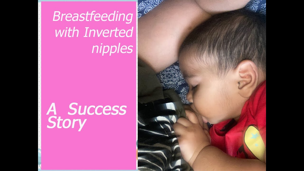How I breastfeed with Inverted Nipples Part 2 (Success Story) Tamil