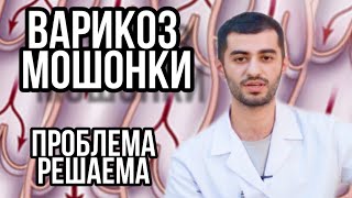 Почему болит яичко? (мошонка), варикоцеле лечится