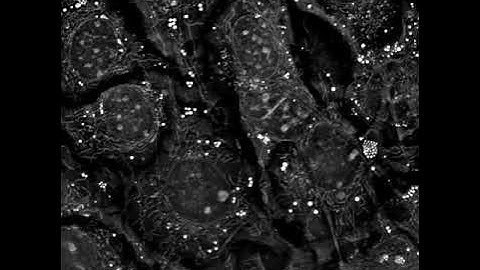 Label-free microscopy: Long Term Live Imaging of Mouse Pre-adipocytes (48hrs)