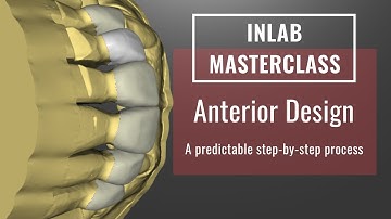 InLab 18: Anterior Design Tips & Tricks