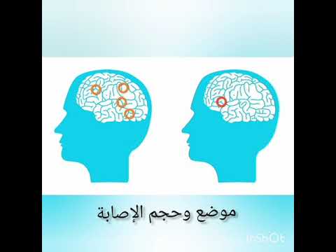 الأفازيا ج05 1