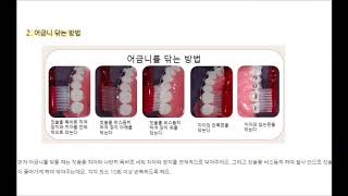 치아교정 중 양치질 올바르게 하는 법