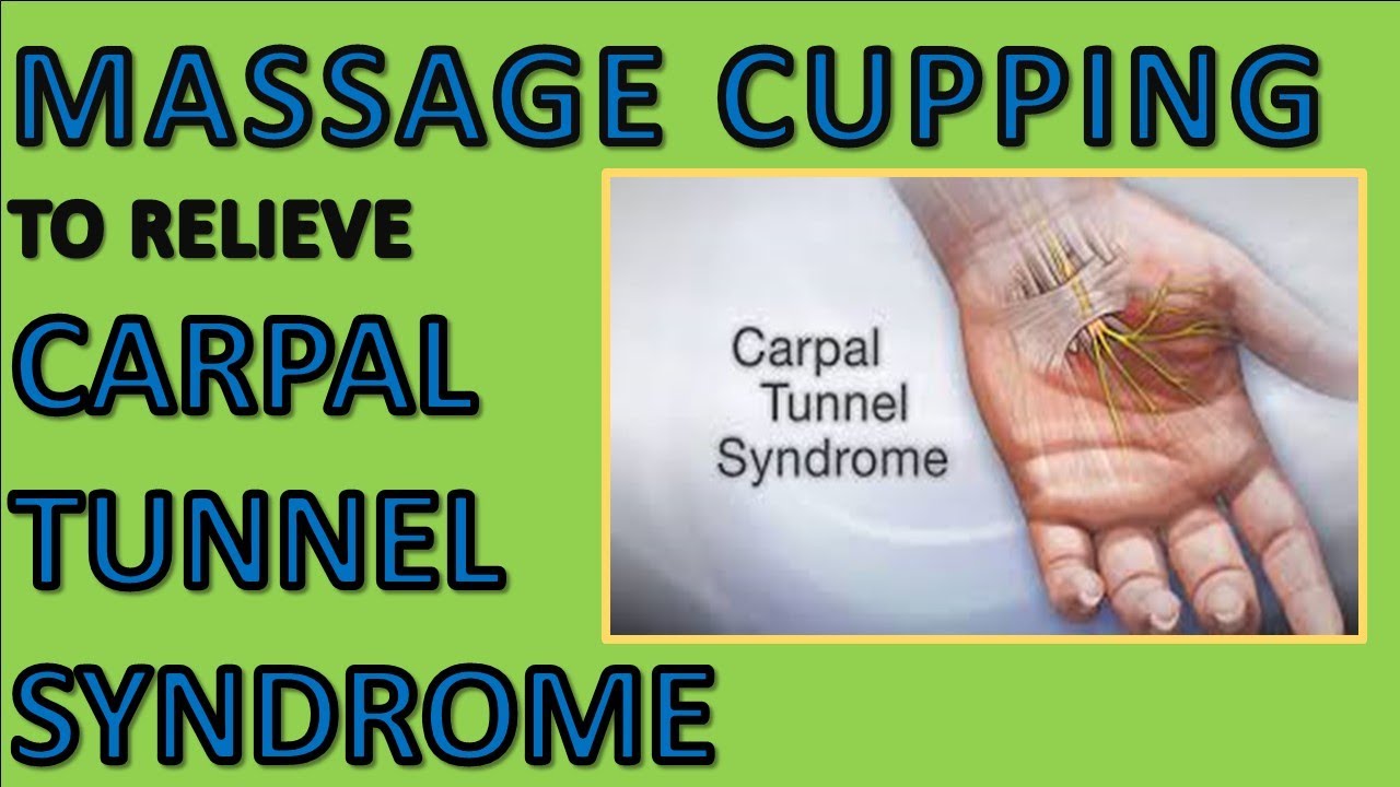 🖐how To Relieve Carpal Tunnel Syndrome With Massage Cupping And Gua Sha Treatment April 2020🖐