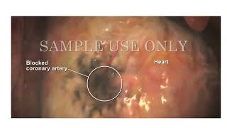 LDL and HDL Cholesterol | Good and Bad Cholesterol | Nucleus Health