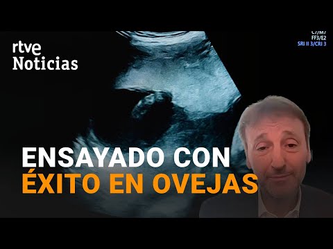 CIENCIA-PLACENTA ARTIFICIAL: Podría