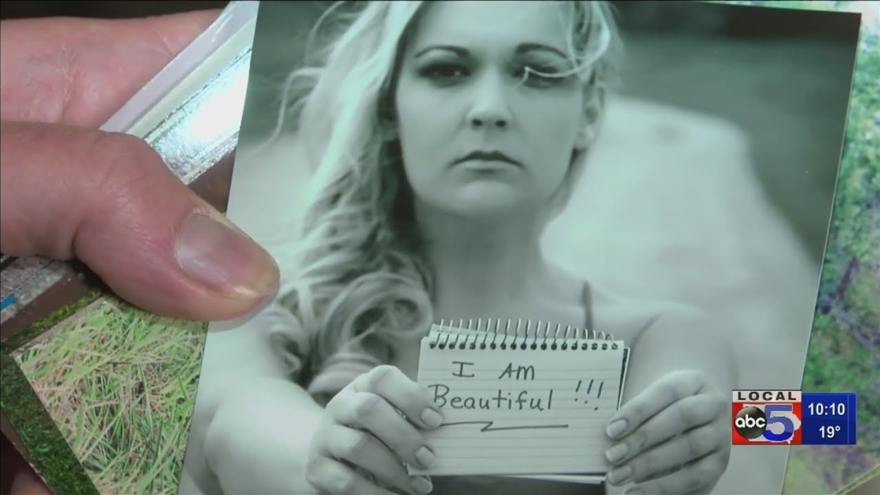 Woman explains scary breast cancer complications