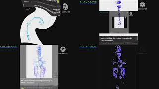 Preview 2 Fmaj Vocoder Quadparison2 8