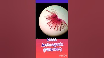Microscopic Slide Of Moss - Archaegonia and Antheridia -Bryophyte 🍃🍃 #shorts #neet #moss #bryophyte