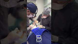 Chin implant surgery