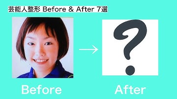 芸能人の整形 【Before & After】 ７選