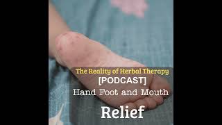 Hand, Foot & Mouth Relief: Herbal Hacks to Soothe Sores Fast