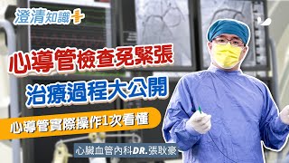 【澄清知識＋】心導管檢查 治療過程大公開-心臟血管內科 張耿豪醫師